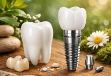 Samsun'da Güler yüzlü ve Güvenilir Diş Tedavisi: Özel Dentalpark Kliniği